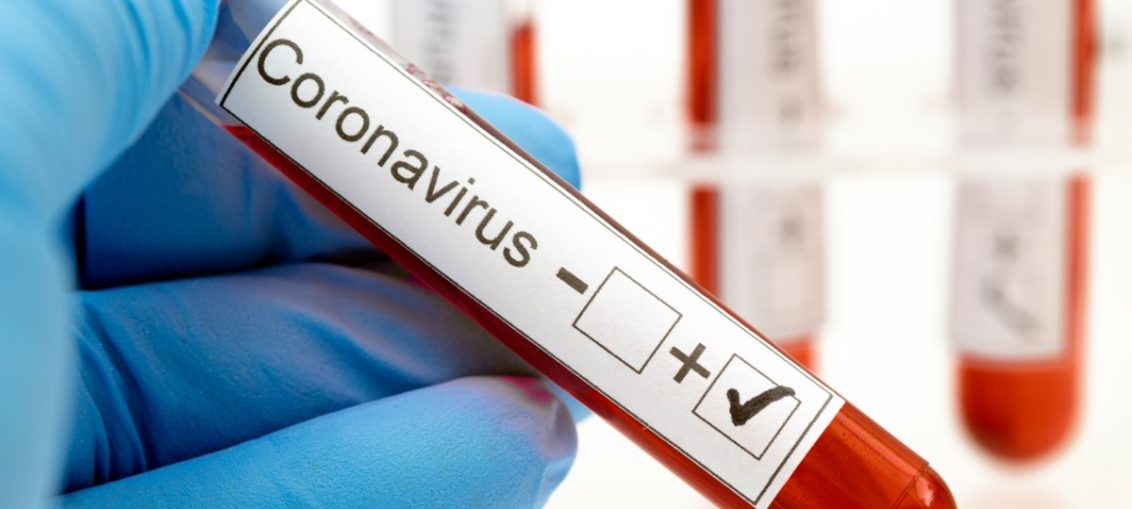 El estudio se propone obtener estimaciones precisas del estado inmunológico de la población, monitorizar la evolución de la epidemia e identificar los factores de riesgo más importantes a los efectos de infestarse con el virus SARS-CoV-2.