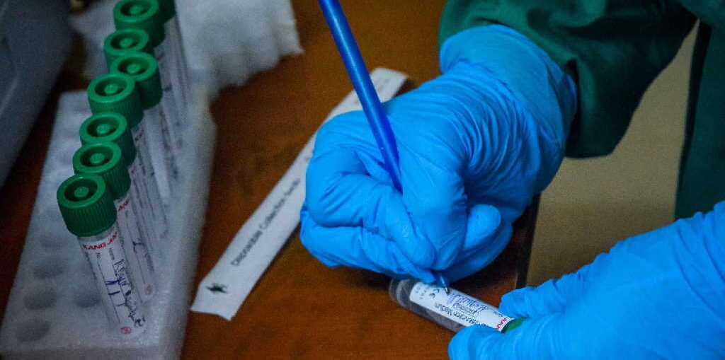 El Jefe Nacional Epidemiología del MINSAP, Dr. Francisco Durán, detalló que para la detección del virus se estudiaron la víspera 53 918 muestras y en la isla han analizado un total de 8 889 419 pruebas.