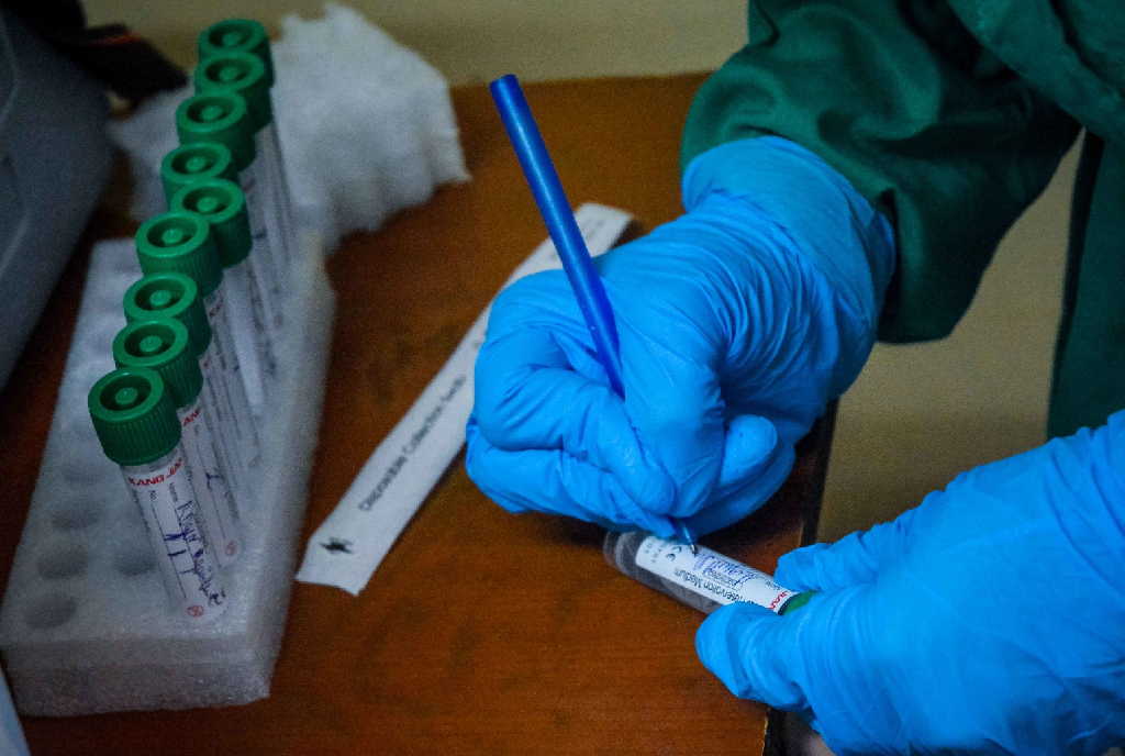 Se acumulan 9 731 983 muestras realizadas para el diagnóstico del SARS-Cov-2 y 895 719 personas diagnosticadas con la enfermedad (9.2%).