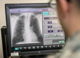 El propósito es aumentar los aportes médicos de los estudios radiológicos mediante la utilización de técnicas de inteligencia artificial que mejoren la calidad de las imágenes.